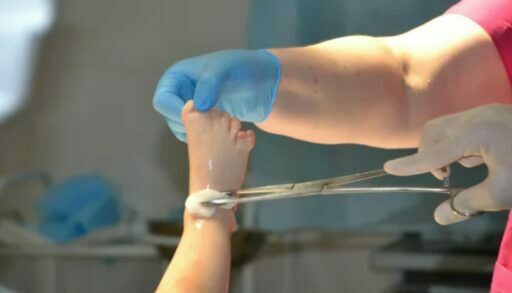 В Тюмени родился малыш с лишними пальцами рук и ног