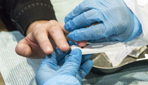 В Тюменской области зарегистрировали первый случай заболевания эпидемическим паротитом