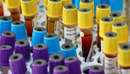 В Тюменской области резко выросла заболеваемость сифилисом