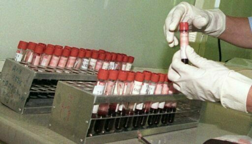 За год почти 760 тысяч тюменцев прошли проверку на наличие ВИЧ