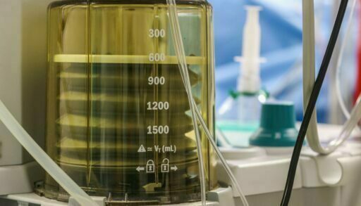 В Тюменской области утвердили программу по борьбе с раком