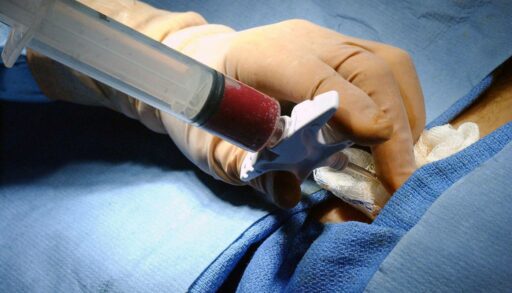 800 тюменцев стали донорами костного мозга