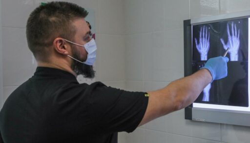 В тюменской школе подросток сломал однокласснику руку