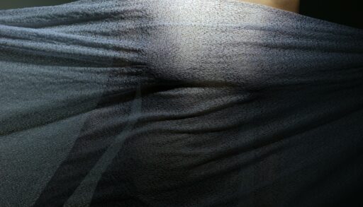 Британка с грудью в 32 кг рассказала о боли, операциях и новой жизни