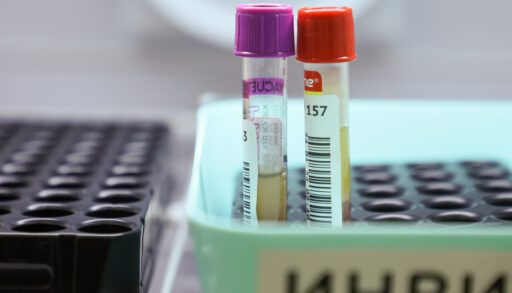 В Тюменской области более 60% случаев рака выявляются на ранних стадиях