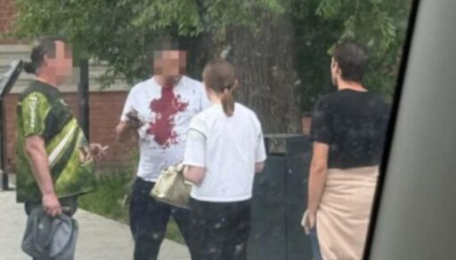 В СКР разберутся с тюменским подростком, разбившем голову водителю автобуса