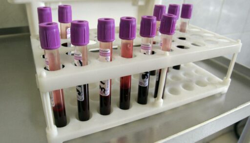 С начала года более 550 тысяч тюменцев прошли тест на ВИЧ