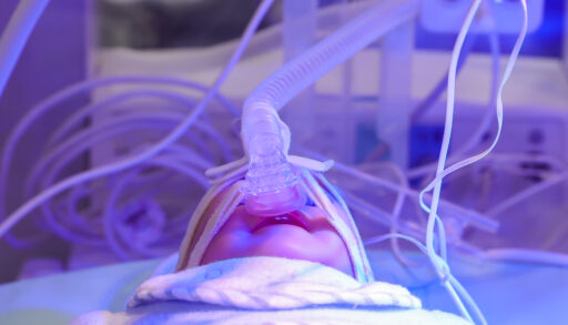 В Тюменской области родились малыши с альбинизмом